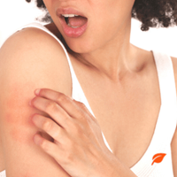 5 producten voor allergie behandeling